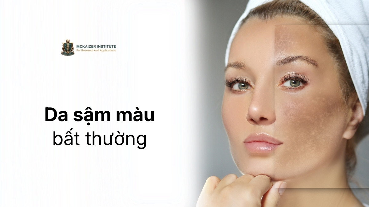 Da sậm màu bất thường liên quan đến rối stress oxy hóa tế bào bên trong