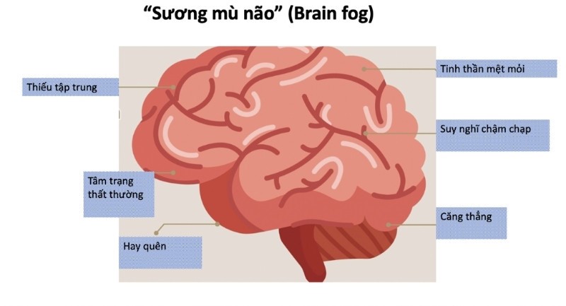 Sương mù não - kẻ thầm lặng khiến bạn mệt mỏi và mất kiểm soát kiểm xúc