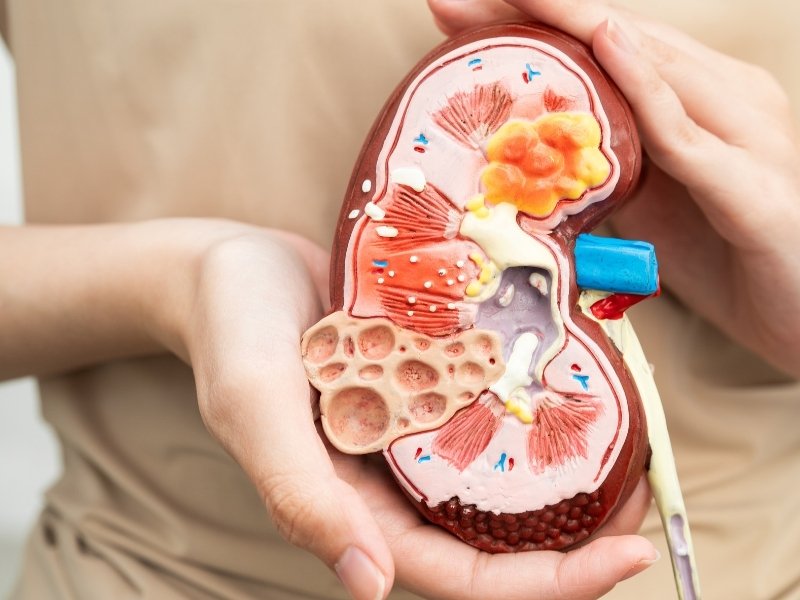 Sút cân mệt mỏi là dấu hiệu bệnh gì? Đây là dấu hiệu bệnh viêm mạn tính như lao phổi, phản ứng miễn