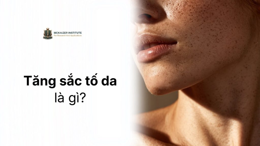 Tăng sắc tố da là gì và vì sao thường đi kèm quá trình lão hóa