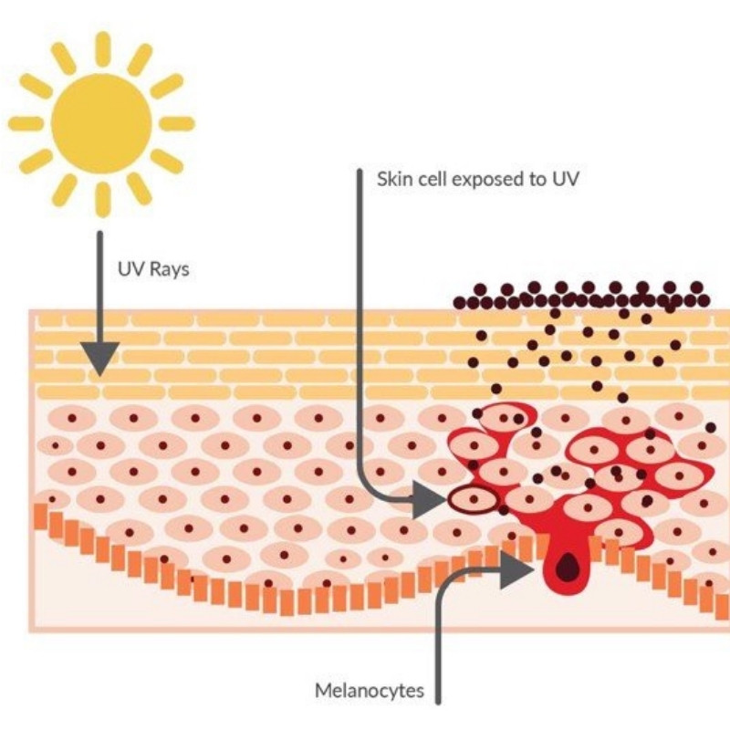 Cơ chế sinh tổng hợp sắc tố da melanin (Nguồn: Internet)